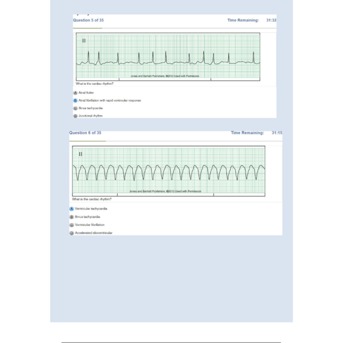 Relias Dysrhythmia Basic Test 35 Questions and Answers 2024 Basic A Dysrhythmia Test Bank Guide 3
