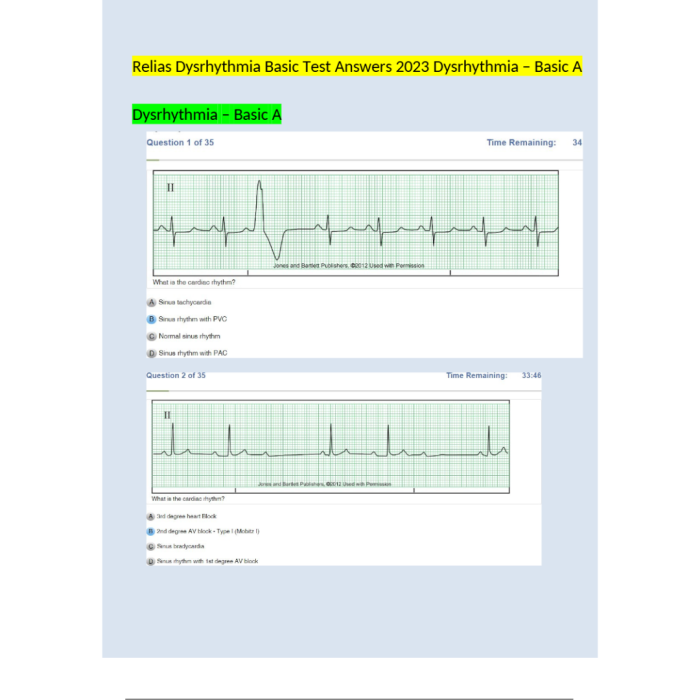 Relias Dysrhythmia Basic Test 35 Questions and Answers 2024 Basic A Dysrhythmia Test Bank Guide 4